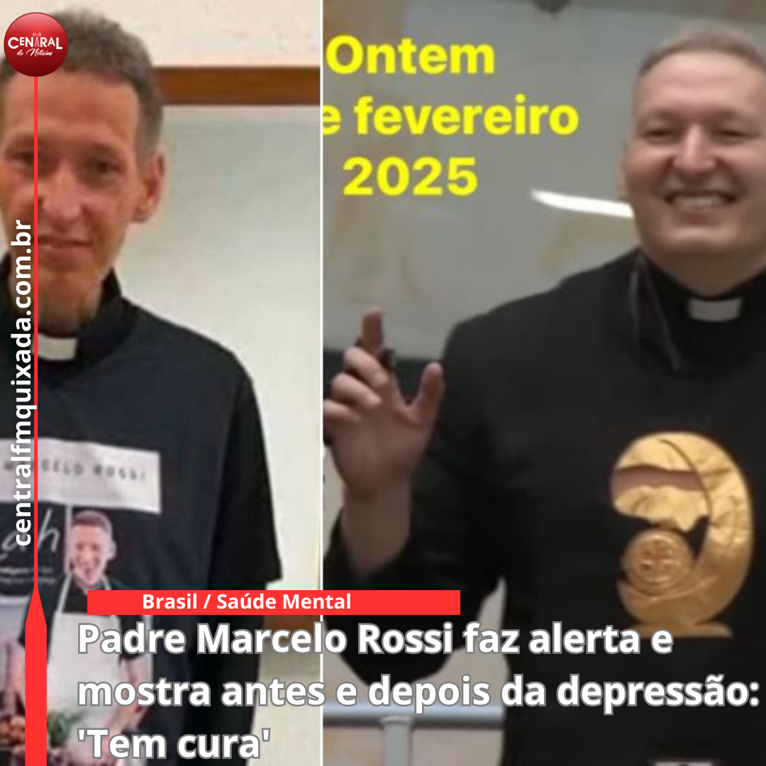 Padre Marcelo Rossi faz alerta e mostra antes e depois da depressão: 'Tem cura'